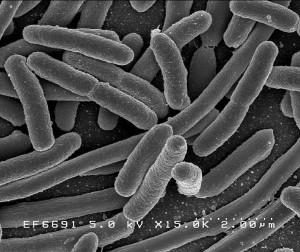 La acción patógena de la bacteria E. coli podría ser paliada por la microalga.