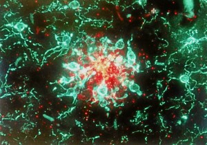 Muestra de cerebro de ratón transgénico.