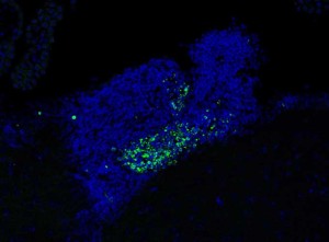 Los puntos verdes representan una acumulación de células muertas en las zonas del cerebro donde se generan nuevas neuronas. / Foto: Paqui González.